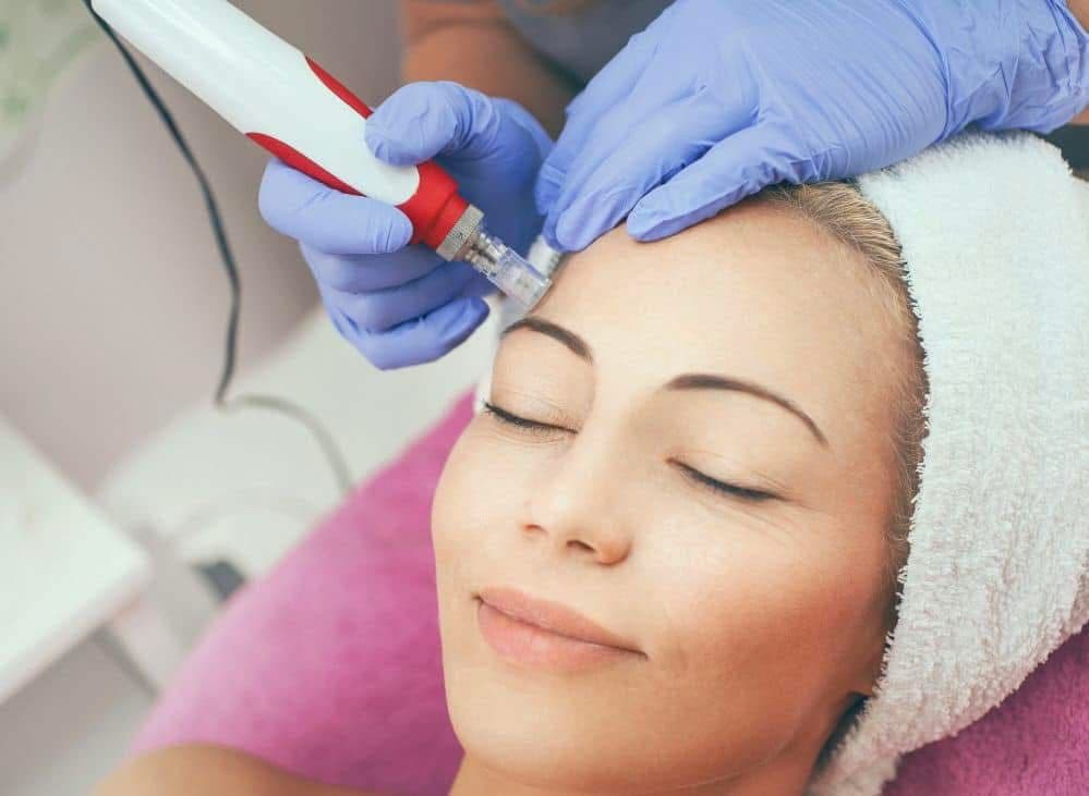 Mezoterapie pleti v salonu Beauty Luxury